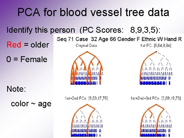 PCA for blood vessel tree data Identify this person (PC Scores: 8, 9, 3,