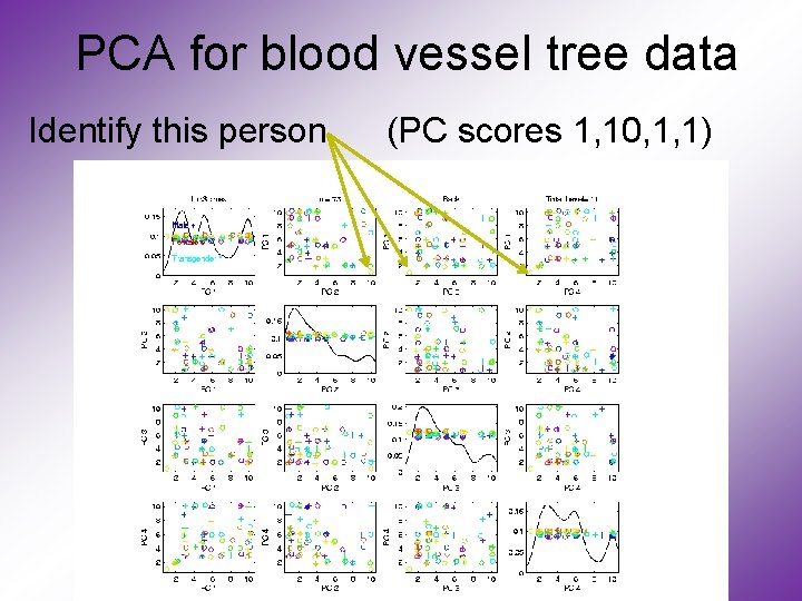 PCA for blood vessel tree data Identify this person (PC scores 1, 10, 1,