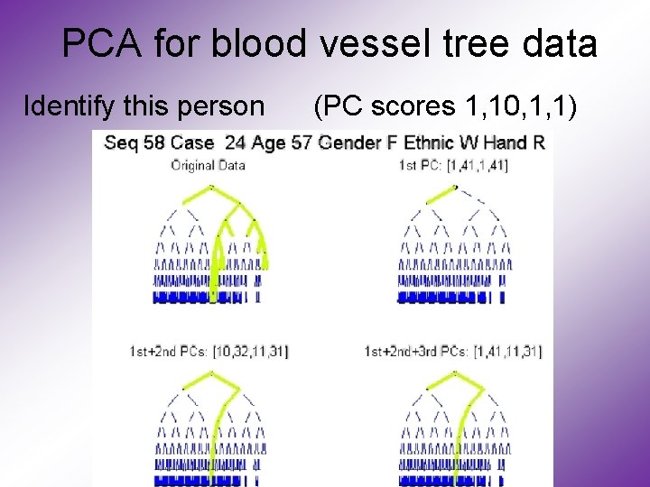 PCA for blood vessel tree data Identify this person (PC scores 1, 10, 1,