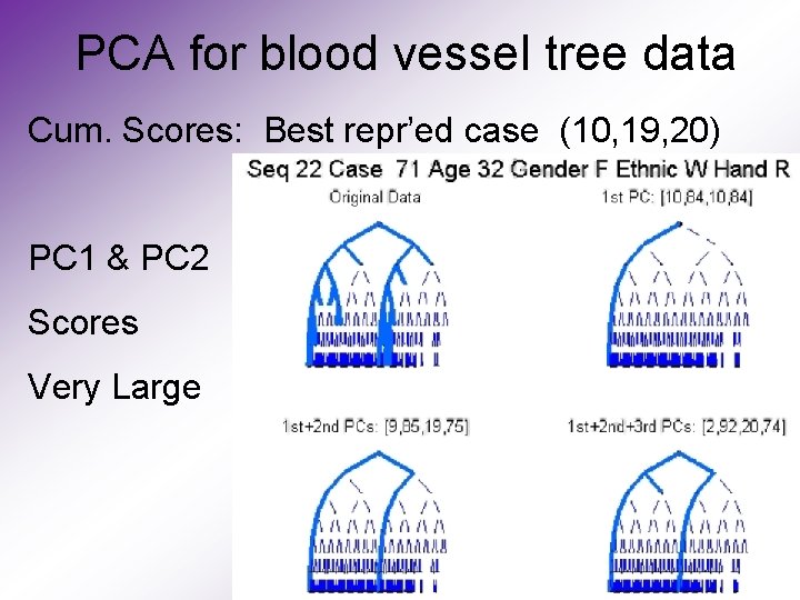 PCA for blood vessel tree data Cum. Scores: Best repr’ed case (10, 19, 20)