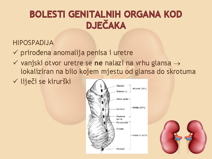 BOLESTI GENITALNIH ORGANA KOD DJEČAKA HIPOSPADIJA ü prirođena anomalija penisa i uretre ü vanjski