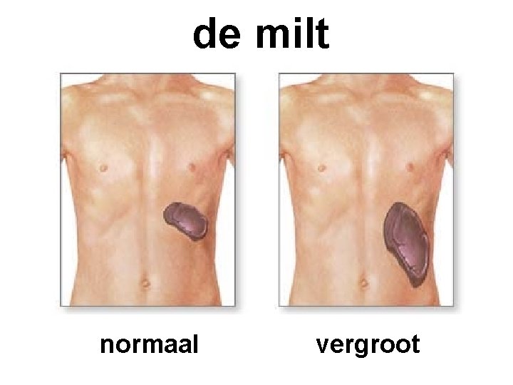 de milt normaal vergroot 