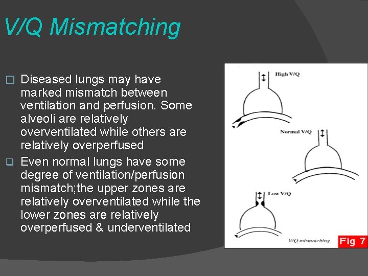 V/Q Mismatching Diseased lungs may have marked mismatch between ventilation and perfusion. Some alveoli
