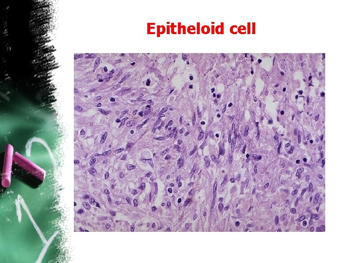 Epitheloid cell 