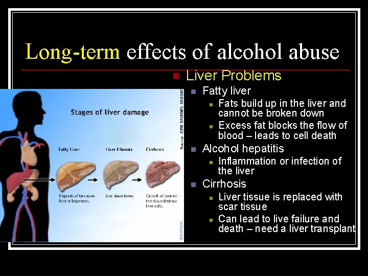 Long-term effects of alcohol abuse n Liver Problems n Fatty liver n n n