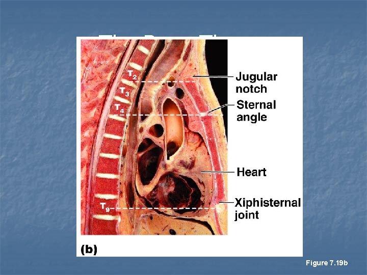 The Bony Thorax Figure 7. 19 b 