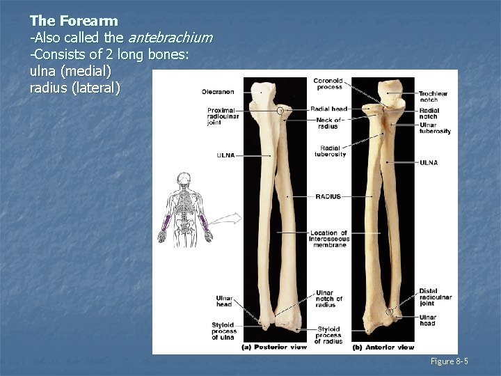 The Forearm -Also called the antebrachium -Consists of 2 long bones: ulna (medial) radius