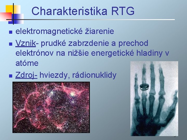 Charakteristika RTG n n n elektromagnetické žiarenie Vznik- prudké zabrzdenie a prechod elektrónov na