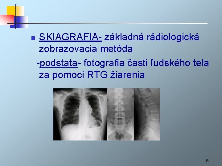 n SKIAGRAFIA- základná rádiologická zobrazovacia metóda -podstata- fotografia časti ľudského tela za pomoci RTG