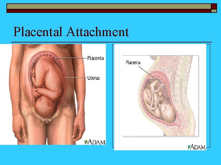 Placental Attachment 