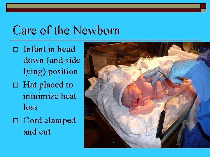 Care of the Newborn o o o Infant in head down (and side lying)