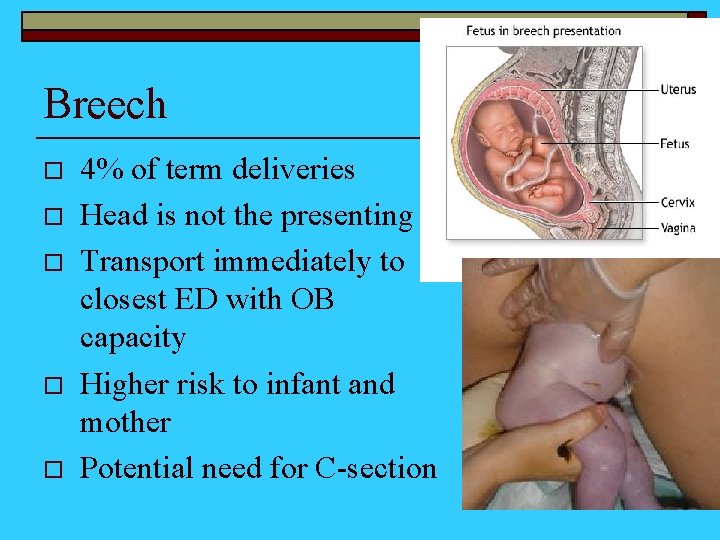 Breech o o o 4% of term deliveries Head is not the presenting Transport