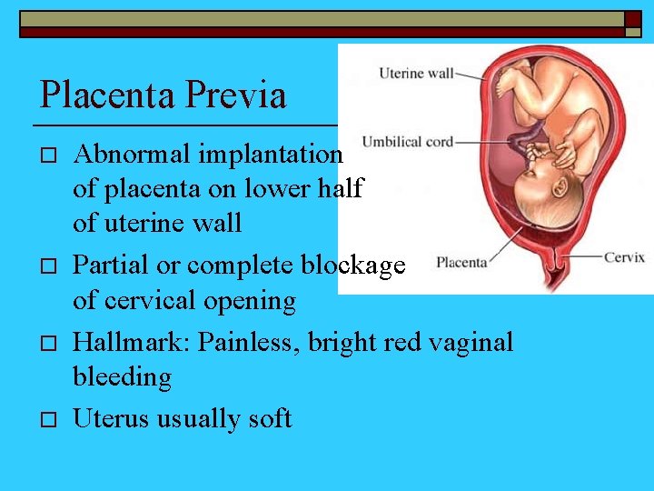 Placenta Previa o o Abnormal implantation of placenta on lower half of uterine wall