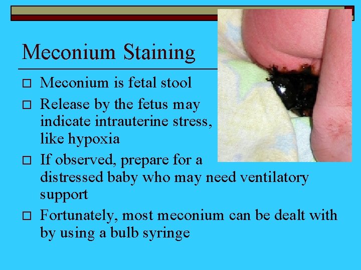 Meconium Staining o o Meconium is fetal stool Release by the fetus may indicate