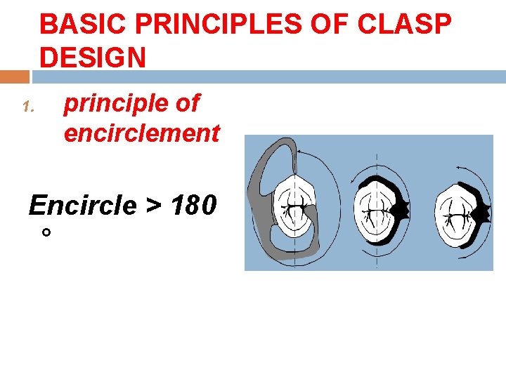 BASIC PRINCIPLES OF CLASP DESIGN 1. principle of encirclement Encircle > 180 ° 