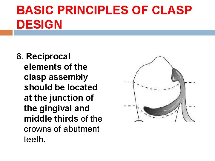 BASIC PRINCIPLES OF CLASP DESIGN 8. Reciprocal elements of the clasp assembly should be