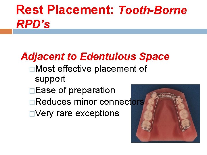 Rest Placement: Tooth-Borne RPD’s Adjacent to Edentulous Space �Most effective placement of support �Ease