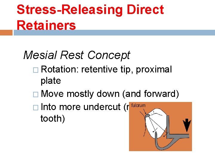 Stress-Releasing Direct Retainers Mesial Rest Concept � Rotation: retentive tip, proximal plate � Move