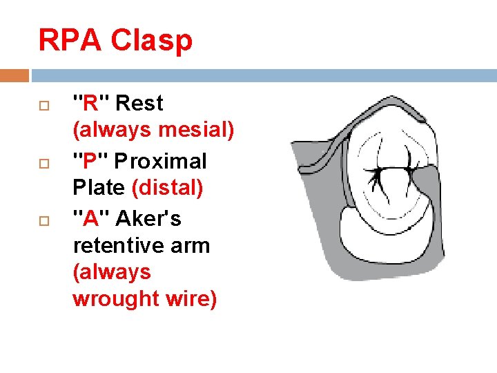 RPA Clasp "R" Rest (always mesial) "P" Proximal Plate (distal) "A" Aker's retentive arm