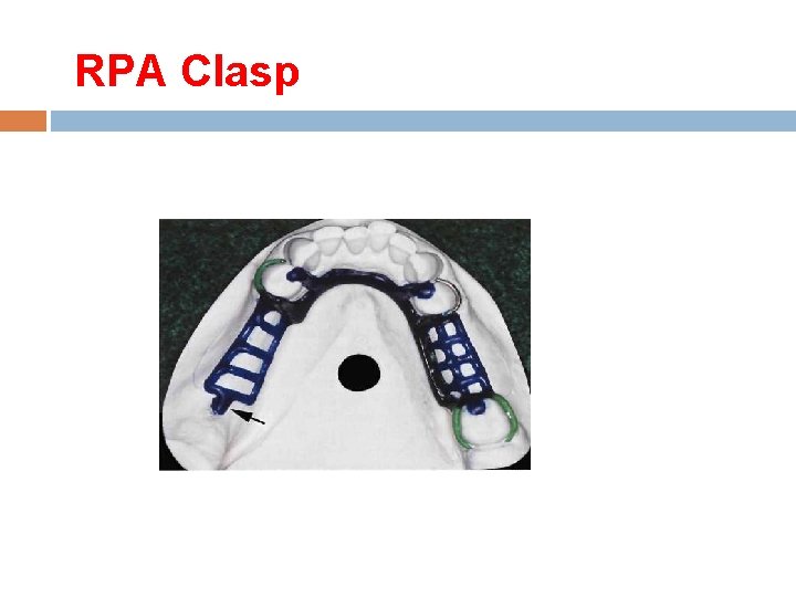 RPA Clasp 