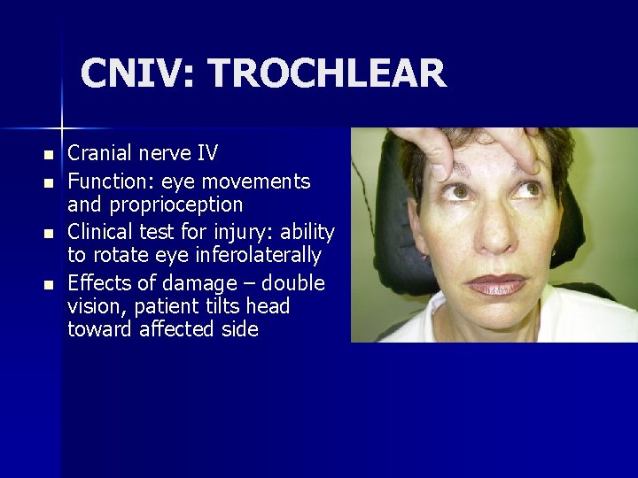 CNIV: TROCHLEAR n n Cranial nerve IV Function: eye movements and proprioception Clinical test