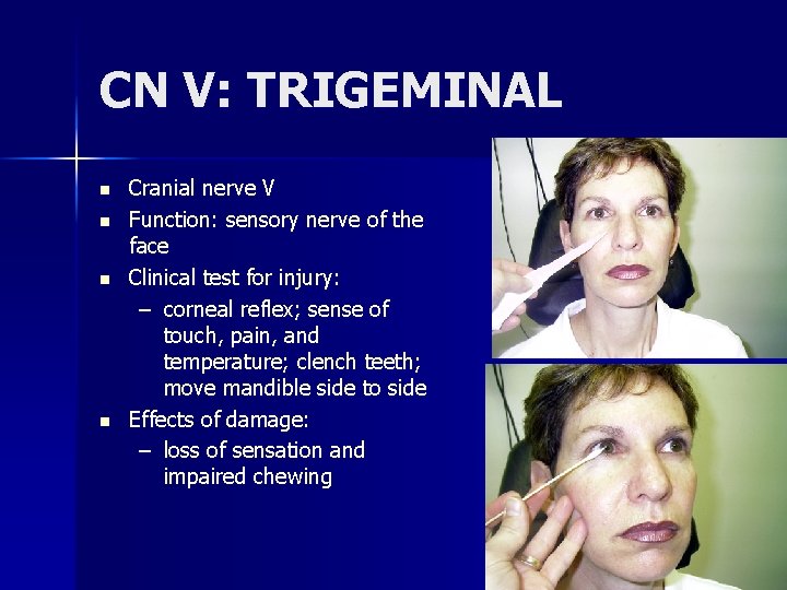 CN V: TRIGEMINAL n n Cranial nerve V Function: sensory nerve of the face