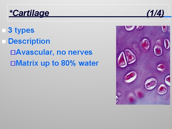 *Cartilage 3 types n Description ¨Avascular, no nerves ¨Matrix up to 80% water n