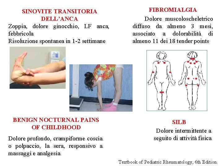 SINOVITE TRANSITORIA DELL’ANCA Zoppia, dolore ginocchio, LF anca, febbricola Risoluzione spontanea in 1 -2