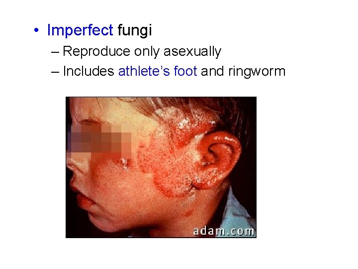  • Imperfect fungi – Reproduce only asexually – Includes athlete’s foot and ringworm