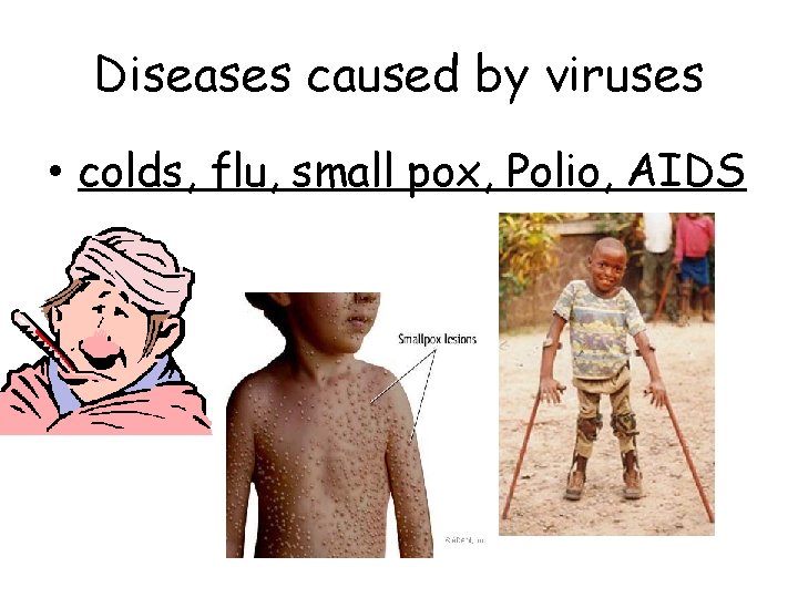 Diseases caused by viruses • colds, flu, small pox, Polio, AIDS 