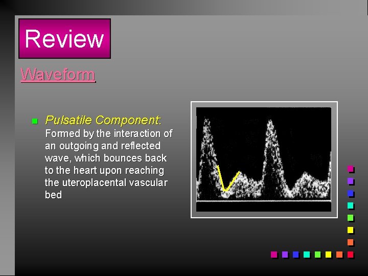 Review Waveform n Pulsatile Component: Formed by the interaction of an outgoing and reflected