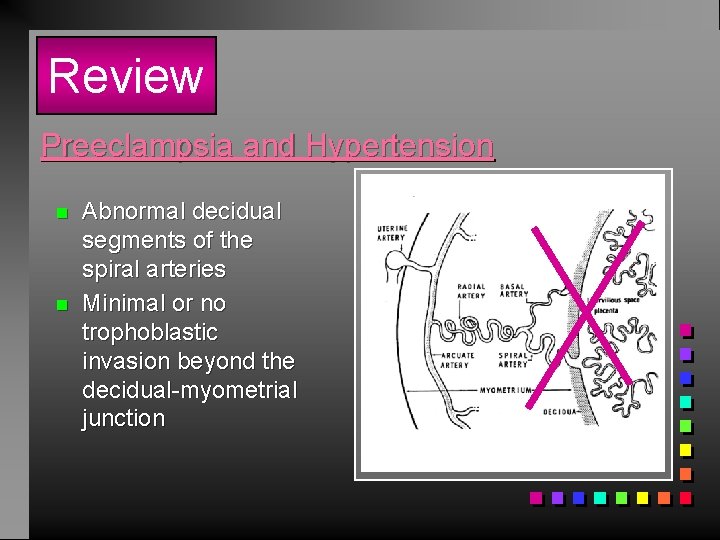 Review Preeclampsia and Hypertension n n Abnormal decidual segments of the spiral arteries Minimal