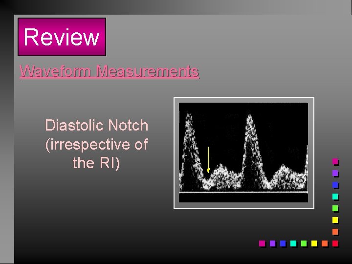 Review Waveform Measurements Diastolic Notch (irrespective of the RI) 