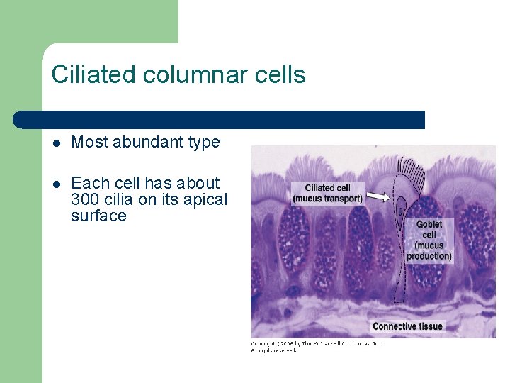 Ciliated columnar cells l Most abundant type l Each cell has about 300 cilia
