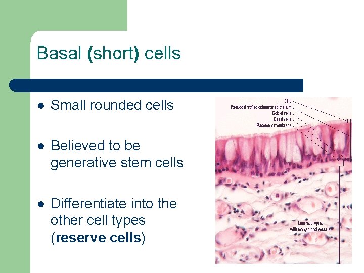 Basal (short) cells l Small rounded cells l Believed to be generative stem cells