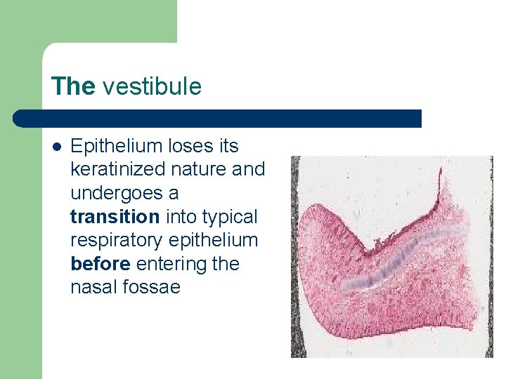 The vestibule l Epithelium loses its keratinized nature and undergoes a transition into typical