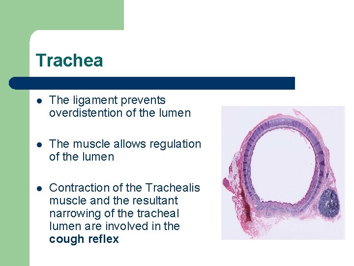 Trachea l The ligament prevents overdistention of the lumen l The muscle allows regulation