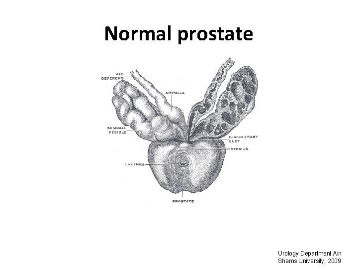 Normal prostate Urology Department Ain Shams University, 2009 