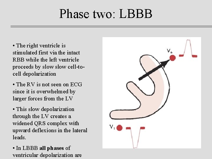 Phase two: LBBB • The right ventricle is stimulated first via the intact RBB