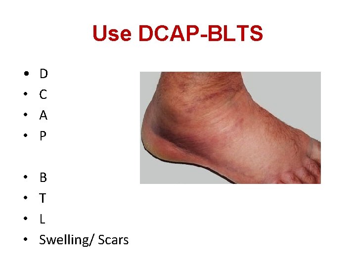 Use DCAP-BLTS • • D C A P • • B T L Swelling/