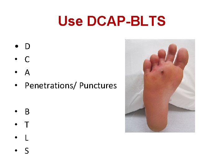 Use DCAP-BLTS • • D C A Penetrations/ Punctures • • B T L