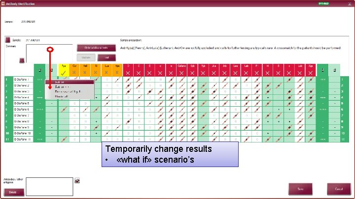 Temporarily change results • «what if» scenario’s 30 