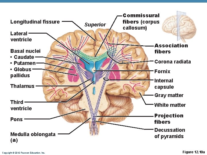 Longitudinal fissure Lateral ventricle Basal nuclei • Caudate • Putamen • Globus pallidus Thalamus