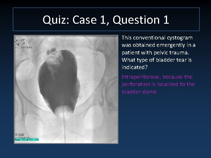 Quiz: Case 1, Question 1 This conventional cystogram was obtained emergently in a patient