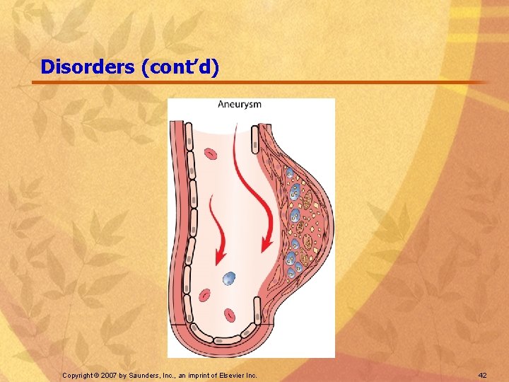 Disorders (cont’d) Copyright © 2007 by Saunders, Inc. , an imprint of Elsevier Inc.