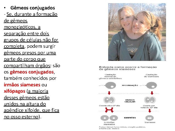  • Gêmeos conjugados - Se, durante a formação de gêmeos monozigóticos, a separação