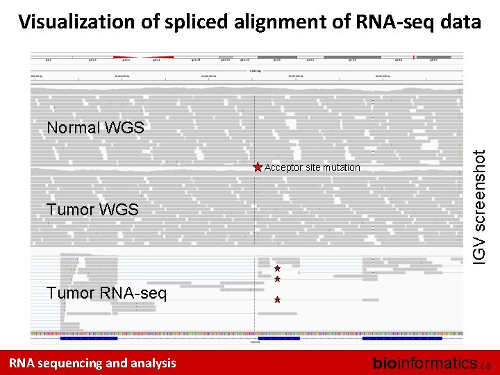 Visualization of spliced alignment of RNA-seq data Acceptor site mutation Tumor WGS IGV screenshot