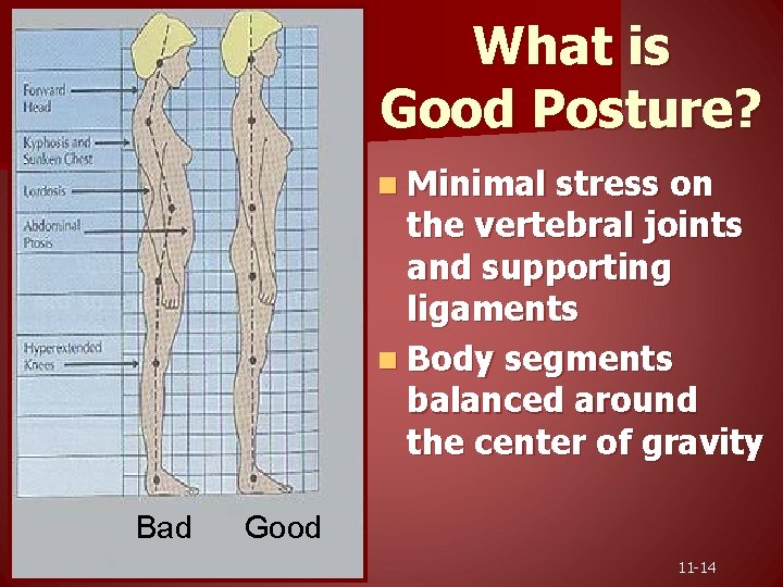 What is Good Posture? n Minimal stress on the vertebral joints and supporting ligaments