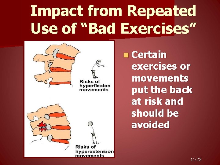 Impact from Repeated Use of “Bad Exercises” n Certain exercises or movements put the