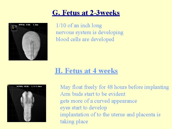 G. Fetus at 2 -3 weeks 1/10 of an inch long nervous system is
